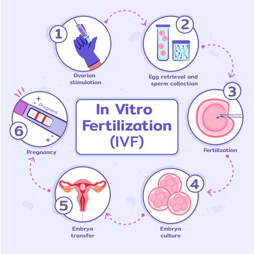 Berikut ini adalah gambar yang mendeskripsikan langkah-langkah In Vitro Fertilization